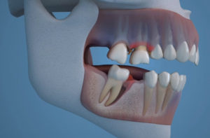 Clínica Dental Clidecem - Dentista de Confianza en Puente Genil - Dientes
