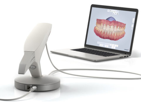 Clínica Dental Clidecem - Dentista de Confianza en Puente Genil - Funciones Dientes - Escaner Intraoral
